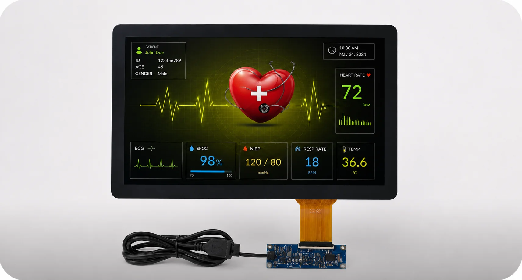 Embedded DisplayPort eDP interface diagram for industrial panel integration